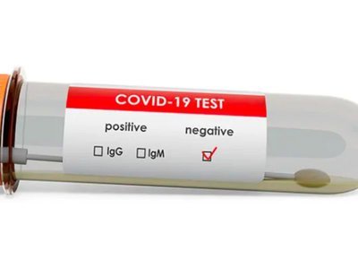 92 samples test negative for Coronavirus