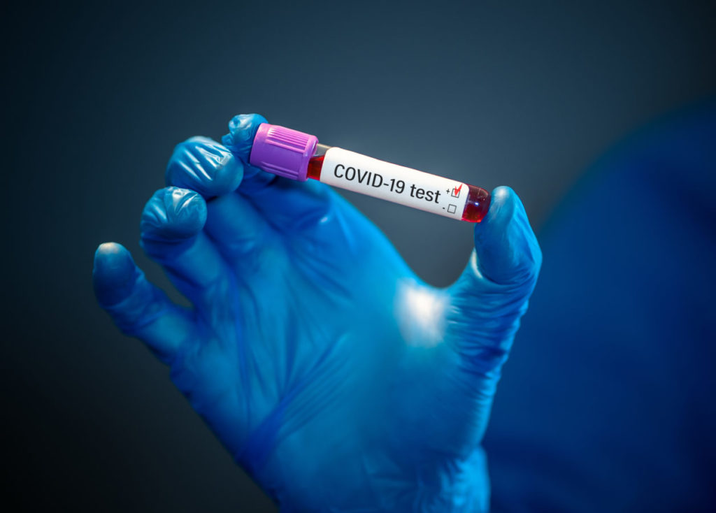 Returning resident tests positive for COVID-19