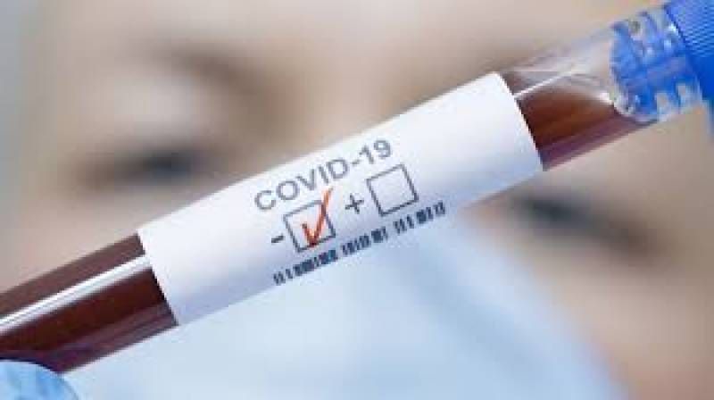 Lone COVID-19 positive person in VI recovers