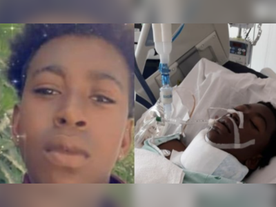 Family seeks help for teen accident victim needing surgery after amputation