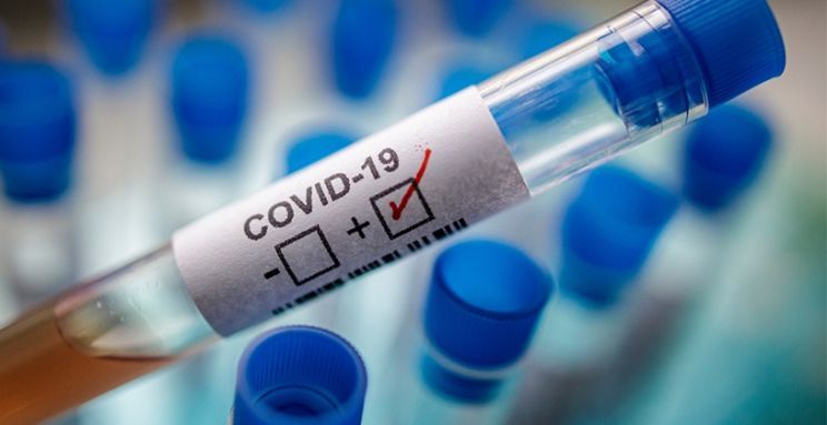 One Active COVID-19 Case ‘Acquired’ Virus Locally