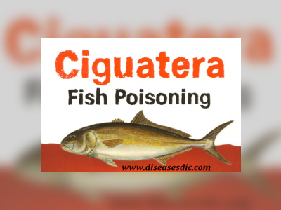 Residents urged to beware of an increase in fish poisoning