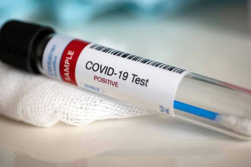 25 Covid 19 Deaths Now In Vi Active Cases Drop To 1 109 British Virgin Islands