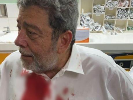 St Vincent Prime Minister bloodied after hit on the head during protest