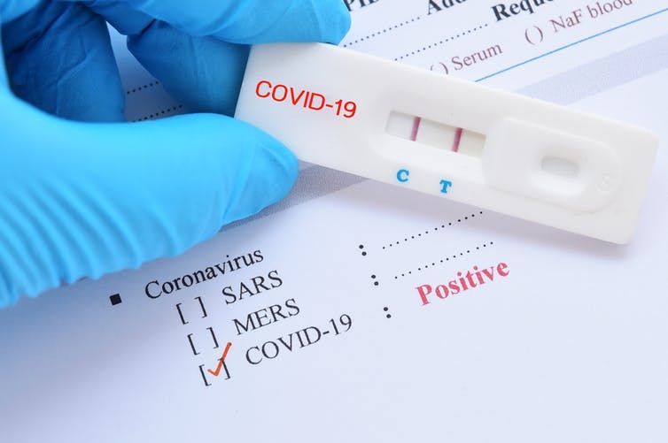 12 active COVID-19 cases currently reported in VI