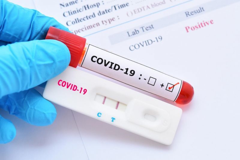 VI's active COVID-19 cases increase to 109; 8 hospitalized