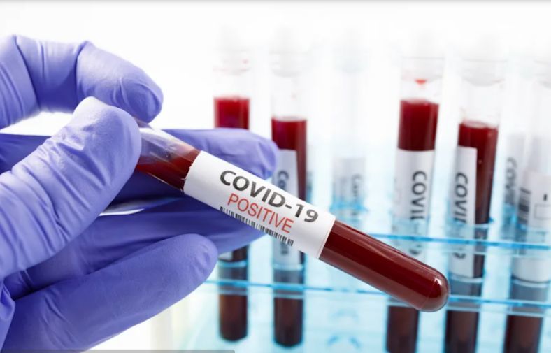 128 active COVID-19 cases recorded in VI
