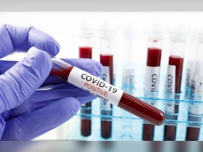 101 active cases of COVID-19 reported in VI