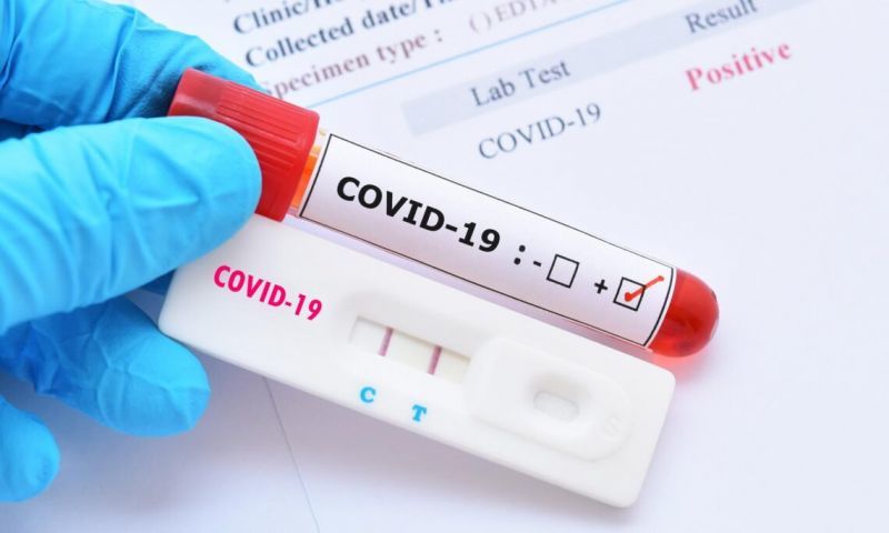 12 Active COVID-19 cases currently in VI