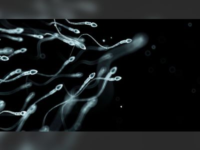 Scientists believe these are the reasons for falling sperm counts